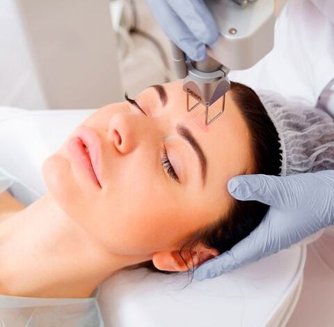 Laser face rejuvenation