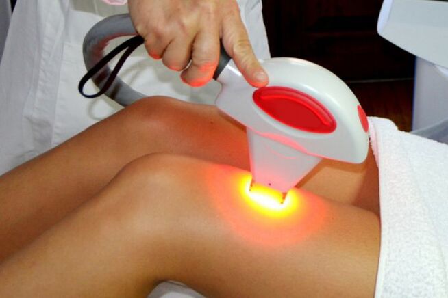 Laser Removal Hair