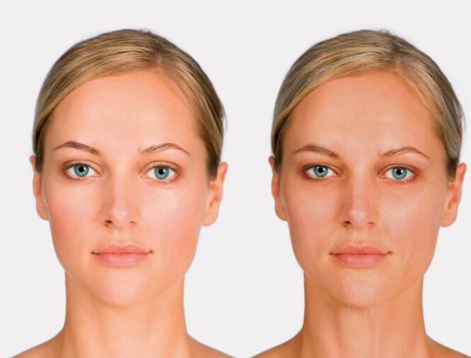 face after and before rejuvenation